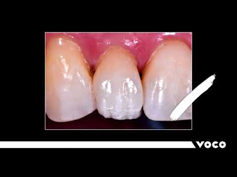 Video dc727aec-b6e8-45e6-8682-b321addf4494