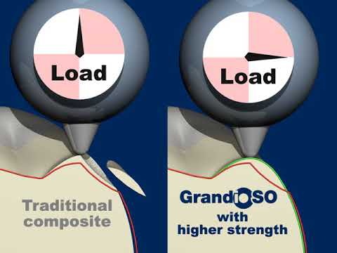Video 5b1b257f-307d-4c26-b6cc-57e23de5f9cf