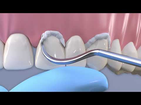 Video 67249cfd-ef4a-426a-9591-db374237f263