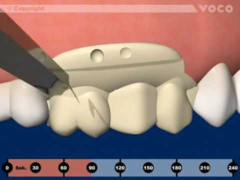 Video ef74bd4f-eacf-48af-a376-5c40d144c253