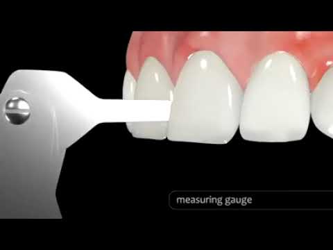 Video d6328e0a-2837-4915-a36f-754cb18e05b9