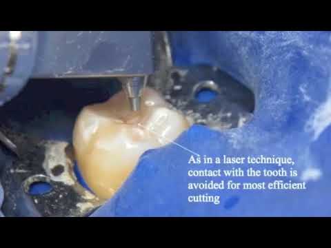 Video a85dda4e-a341-42ba-b2c0-ebb42c214f49