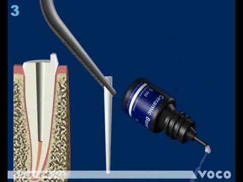 Video bb764119-ca33-44f8-a032-fbbabfcaed63